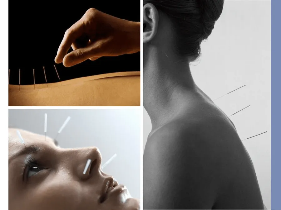 Acupunture Studio at Volta.